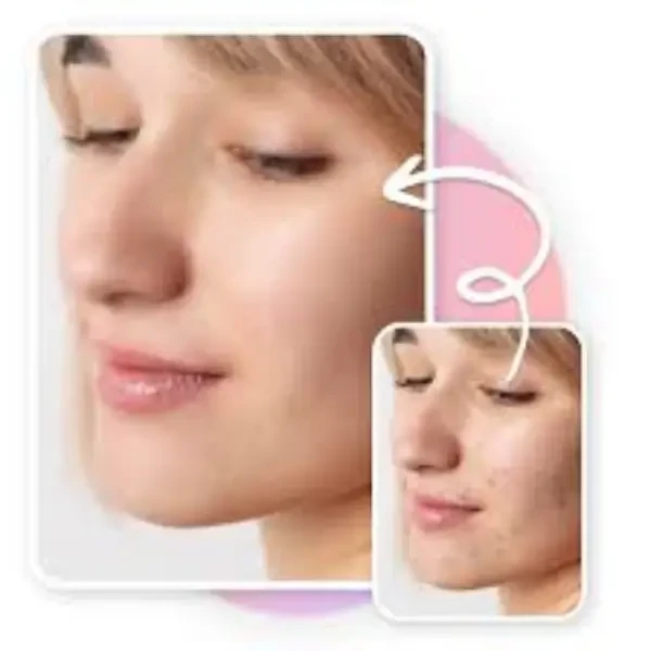 Dark Spots & Blemishes